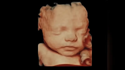 Los zurdos sin escrúpulos lo llaman un conjunto de células. "Los fachas lo llamamos un bebé con vida"